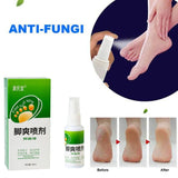 Feet Odor Spray